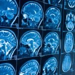 Odisha Signs Agreement to Operate Hydrogen-Powered Buses