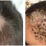 Neera Kashyap Explores Life’s Hidden Fissures